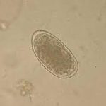 hookworm1